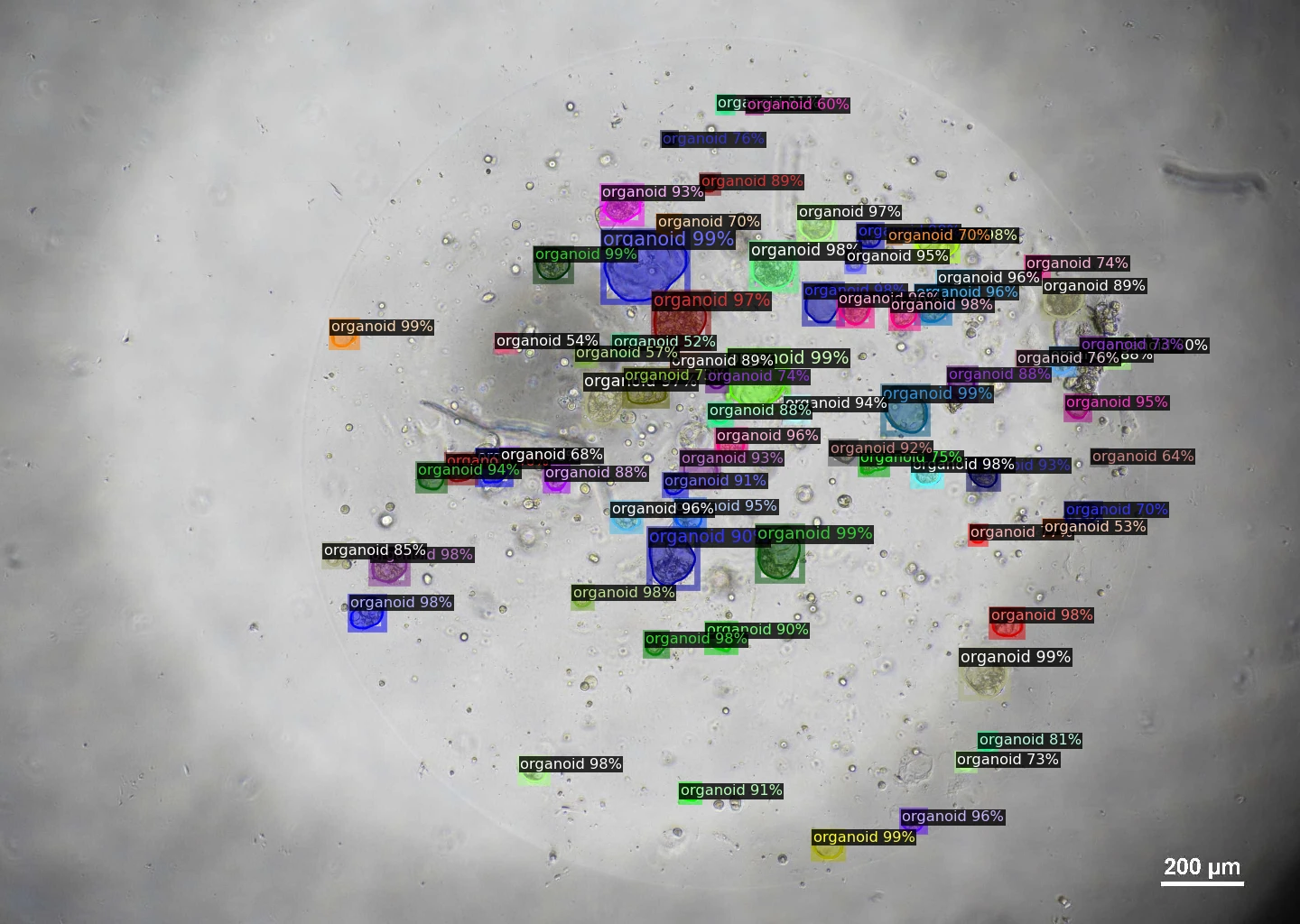 灵犀AI类器官影像系统